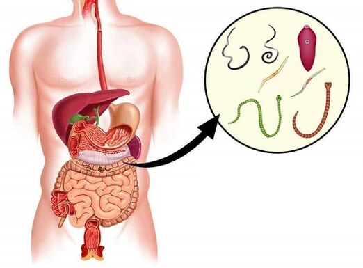 Nemanex елиминира паразитите